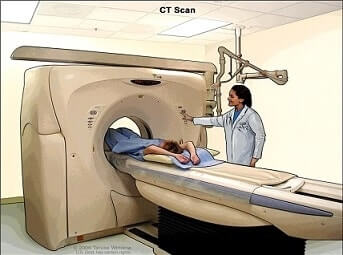 radyasyon tomografi riski